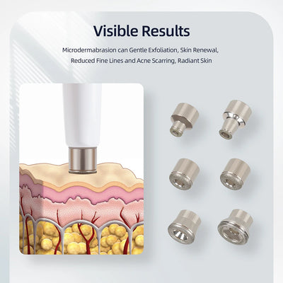 Professional Diamond Microdermabrasion