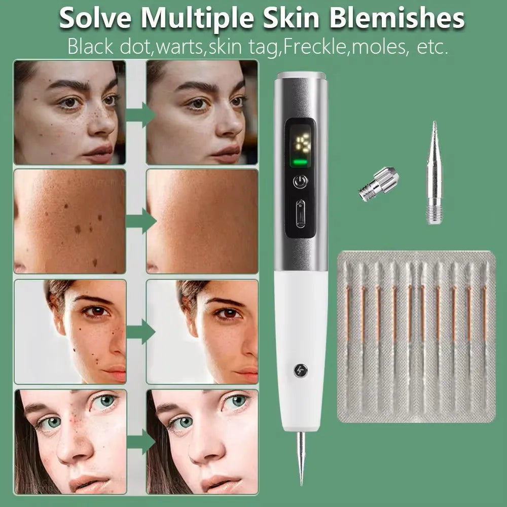 Electric Skin Tag & Mole Remover Pen